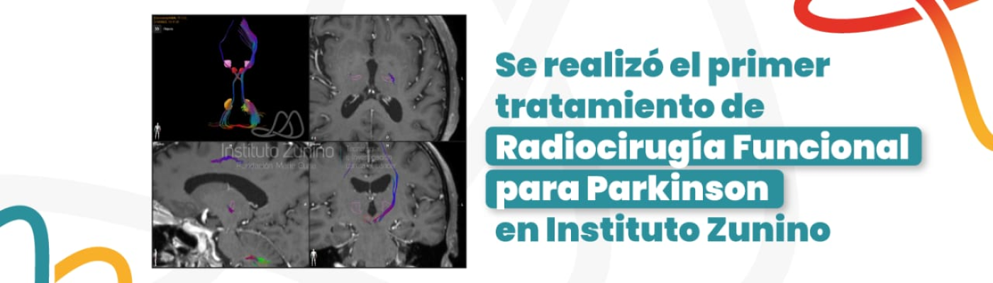Radiocirugía Funcional Para Parkinson