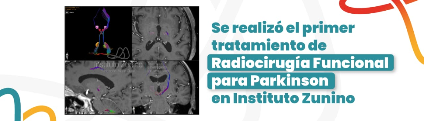 Radiocirugía Funcional Para Parkinson